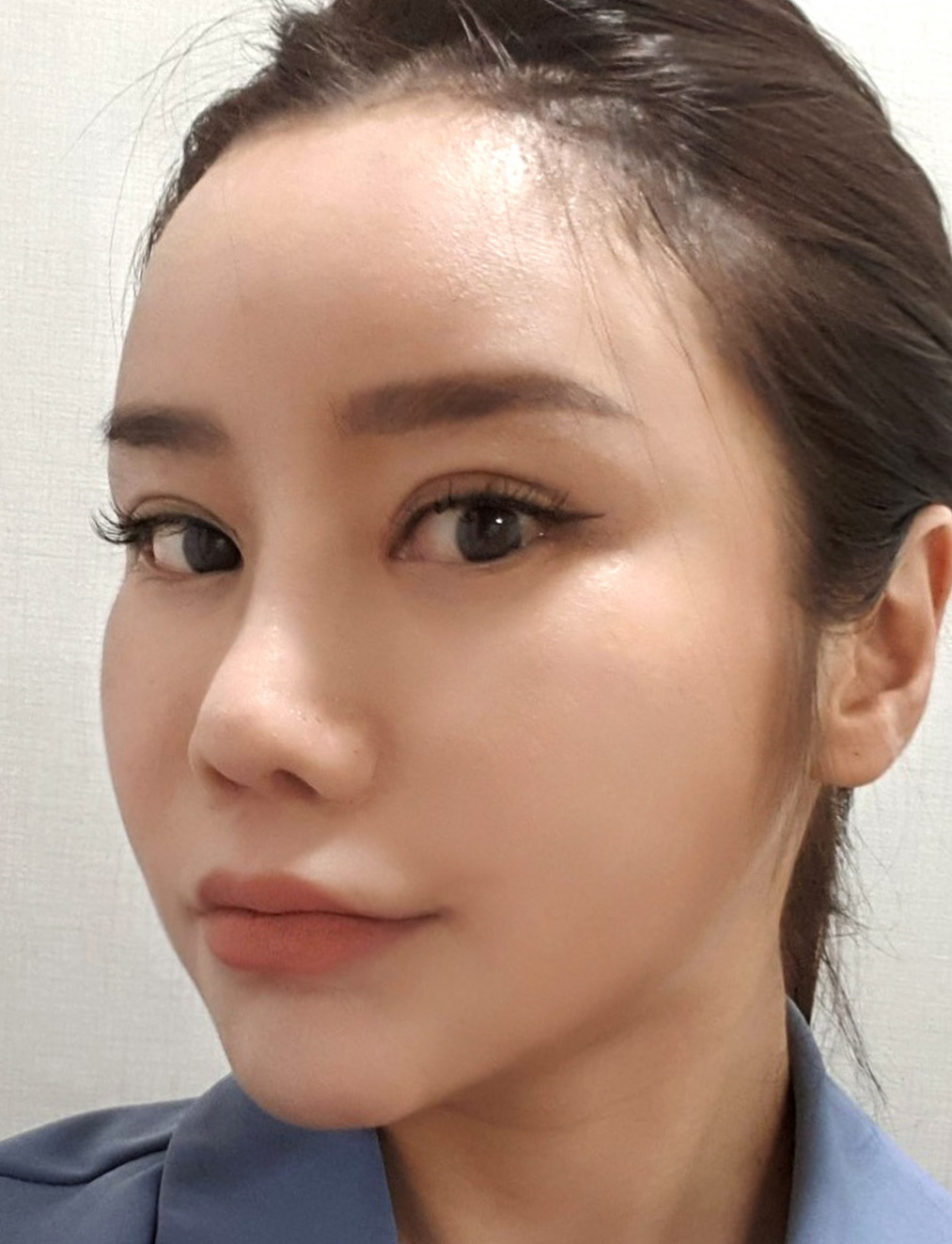 pangpang clinic korea - Before And After