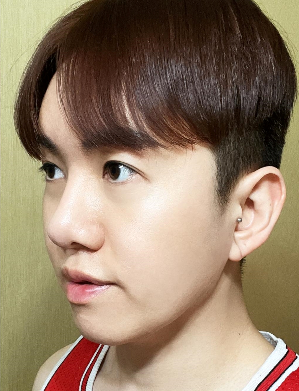 pangpang clinic korea - Before And After