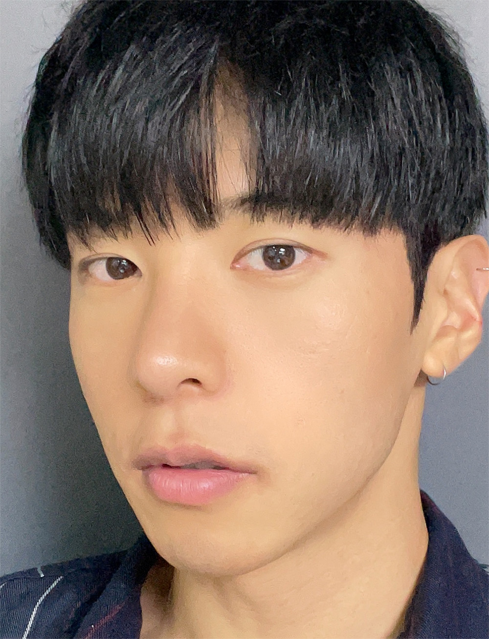 pangpang clinic korea - Before And After