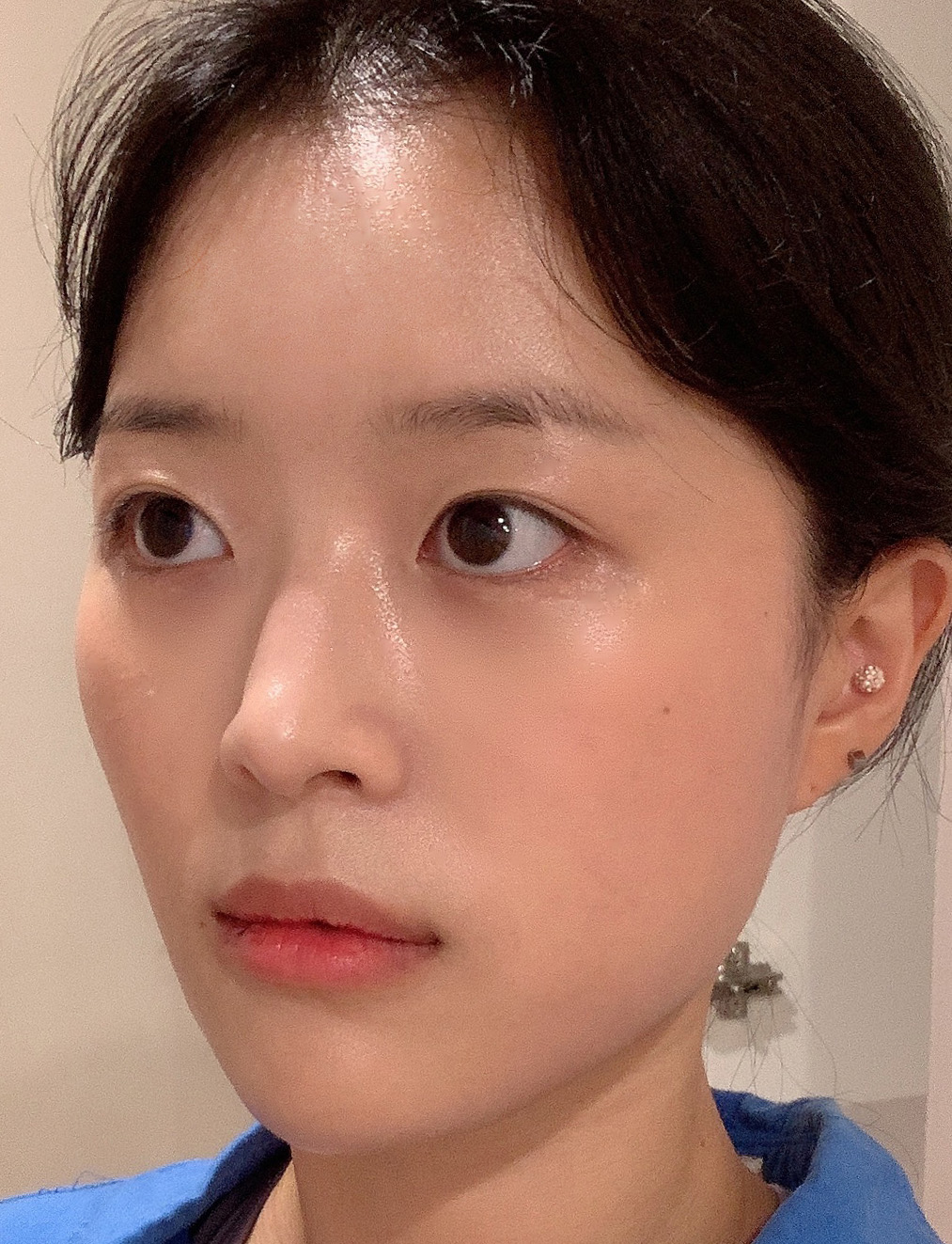 pangpang clinic korea - Before And After
