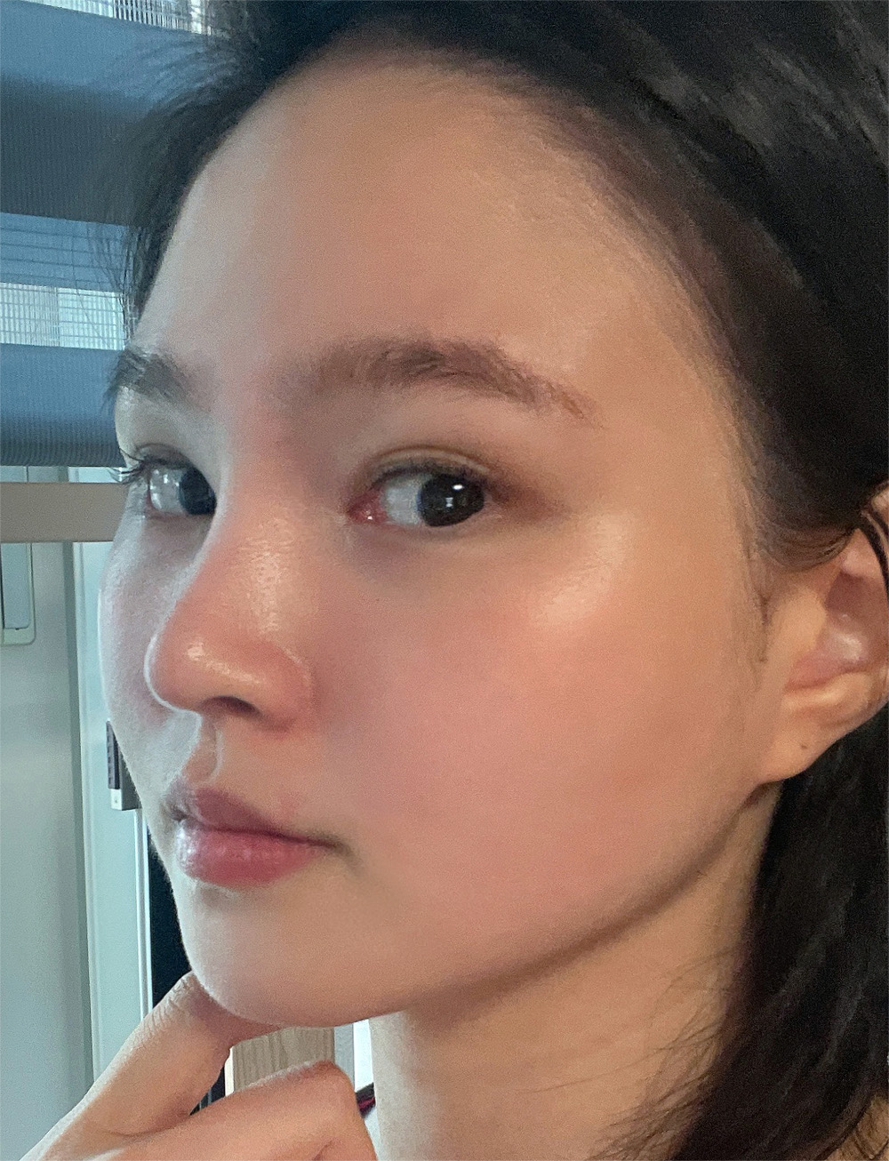 pangpang clinic korea - Before And After