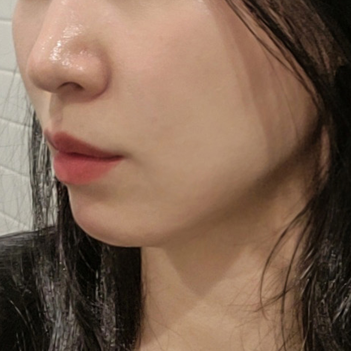 double chin thread lifting in korea pang pang clinic